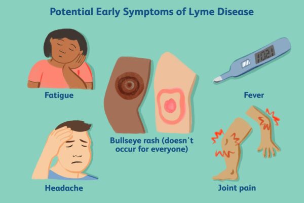 Malattia di Lyme: Sintomi, Cause e Prevenzione