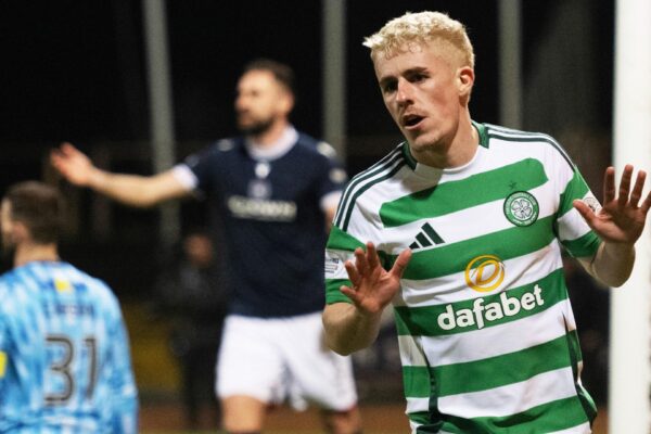 Dundee e Celtic: L’Importanza della Prossima Partita