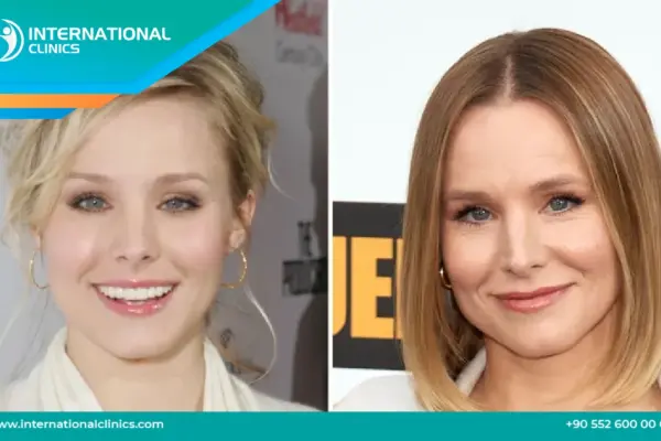 Kristen Bell: Una Panoramica della Sua Carriera e Progetti Recenti