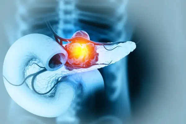 pancreas — IT news