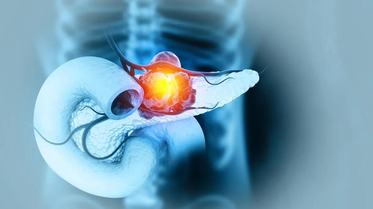 pancreas — IT news